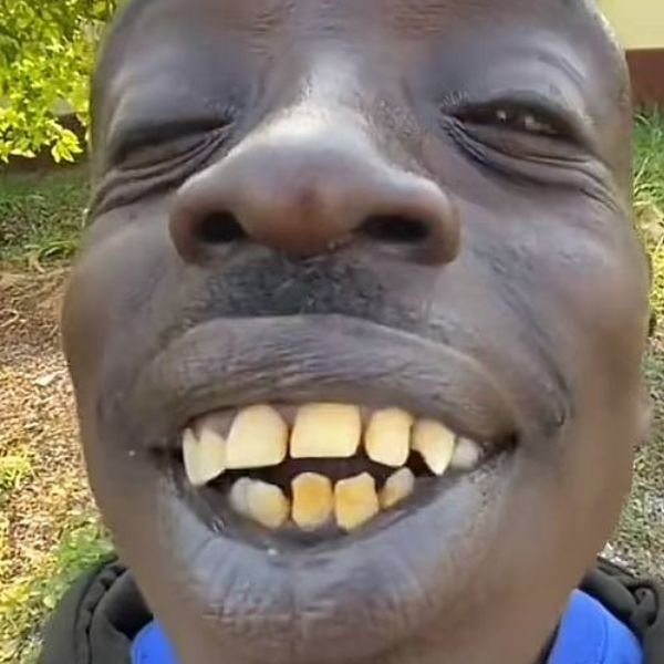 ảnh hôn troll răng thưa