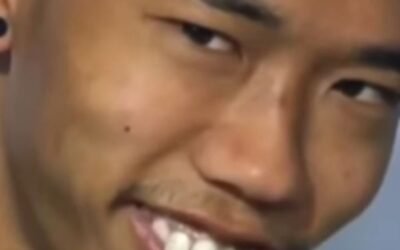 ảnh video troll răng hô