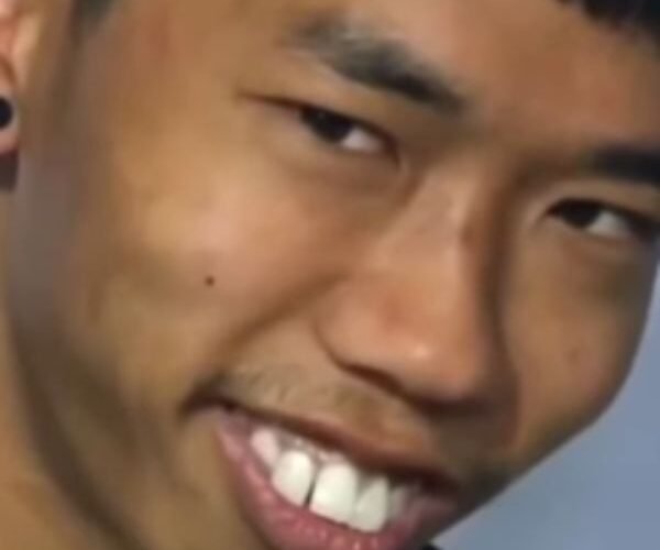 ảnh video troll răng hô