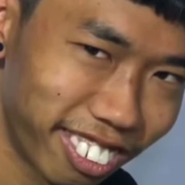 ảnh video troll răng hô